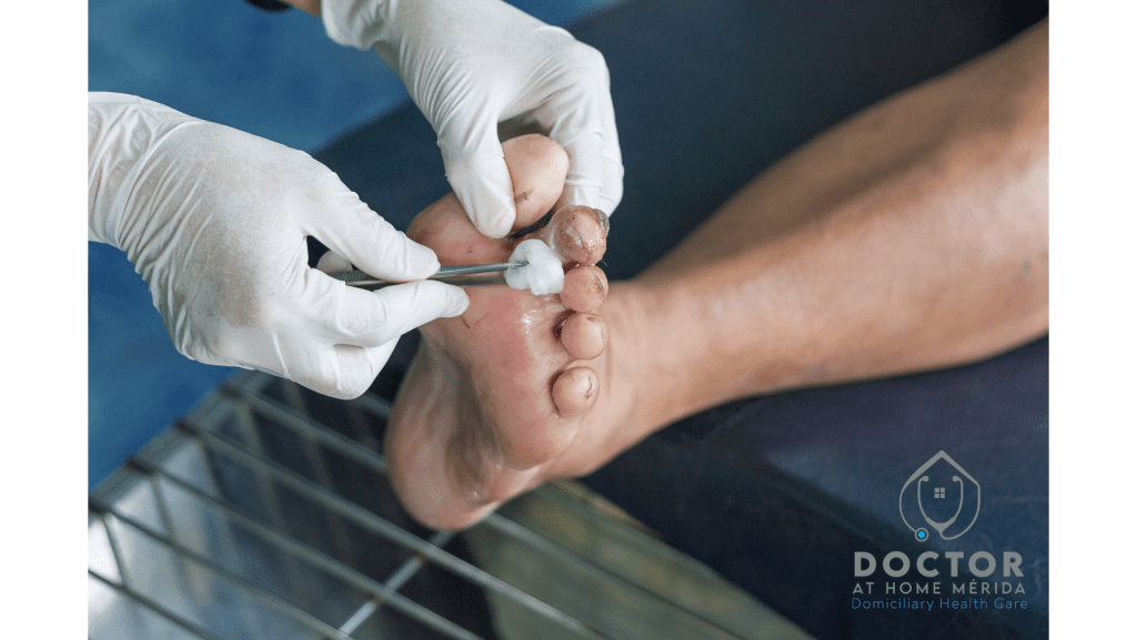 diabetic foot merida