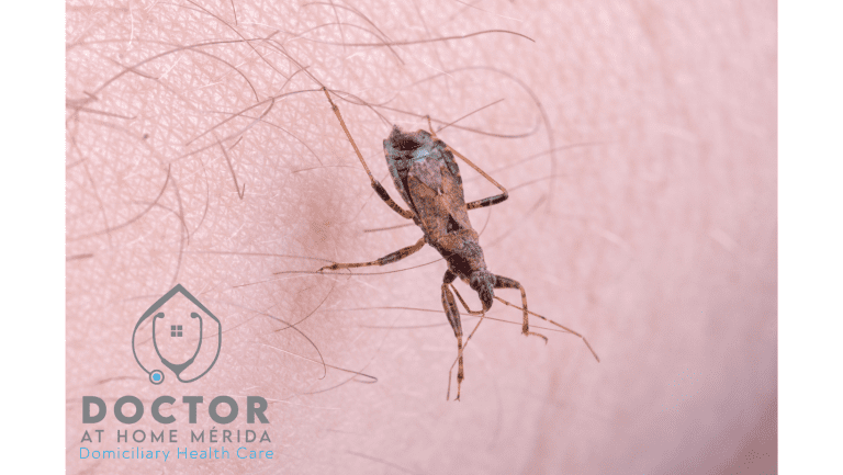 Chagas Disease in Mérida, Yucatán: Causes, Symptoms, Treatments, and Prevention.