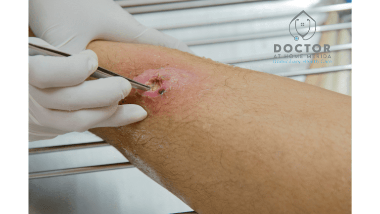 Bedsores: Causes, Treatment, and Prevention – Wound Care